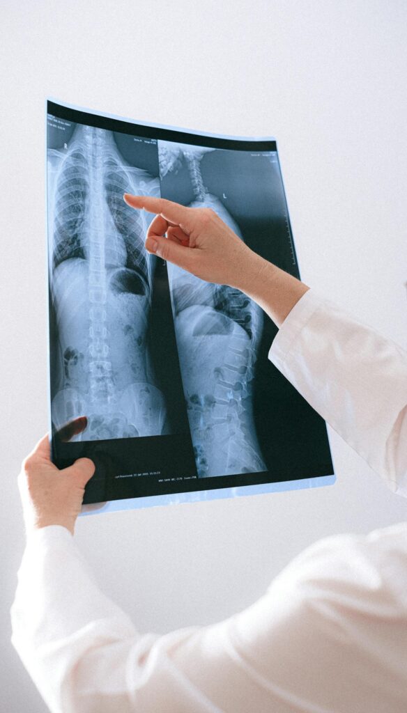 A doctor analyzing a spinal X-ray for medical diagnosis in a healthcare setting.