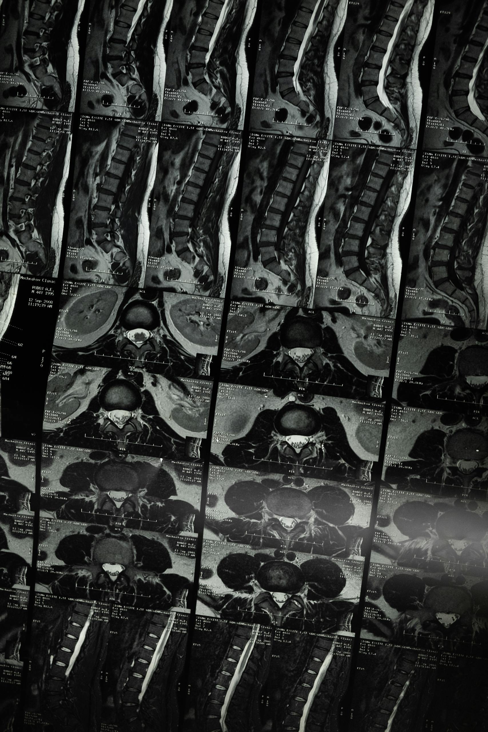 An in-depth medical imaging x-ray series focusing on the human spine in high detail.