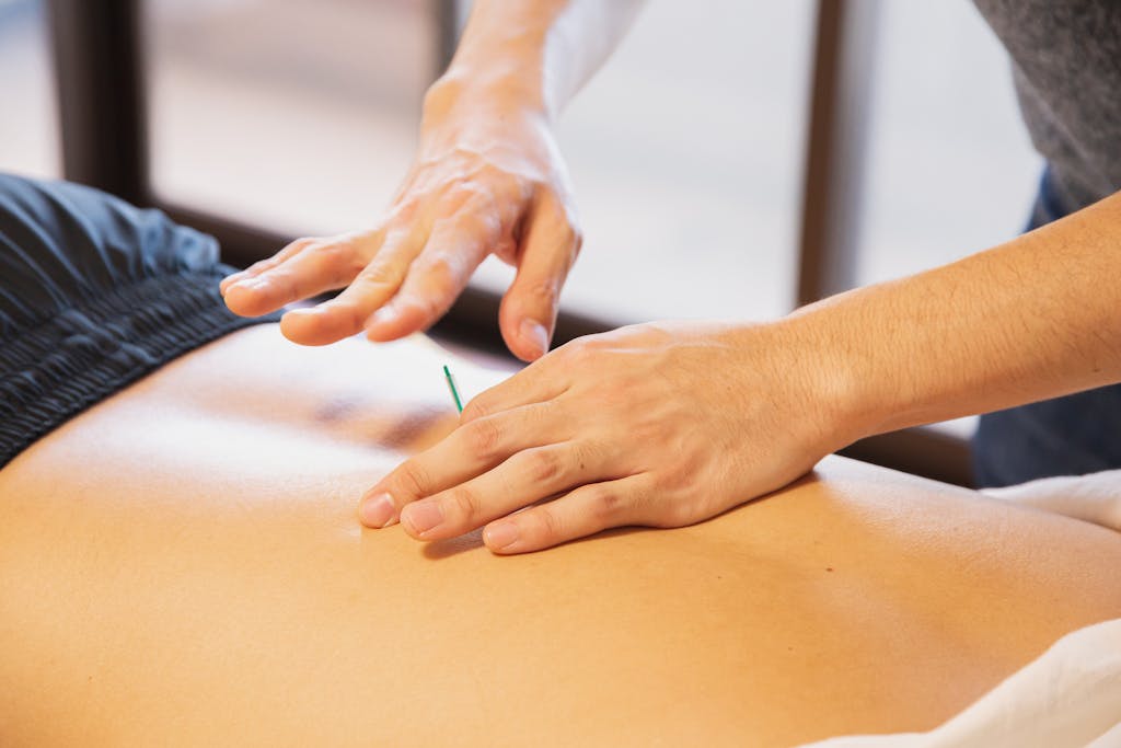 Crop anonymous male doctor putting needles on back during acupuncture therapy session in rehabilitation salon