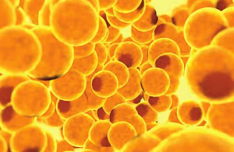 Microscopic fat cells
