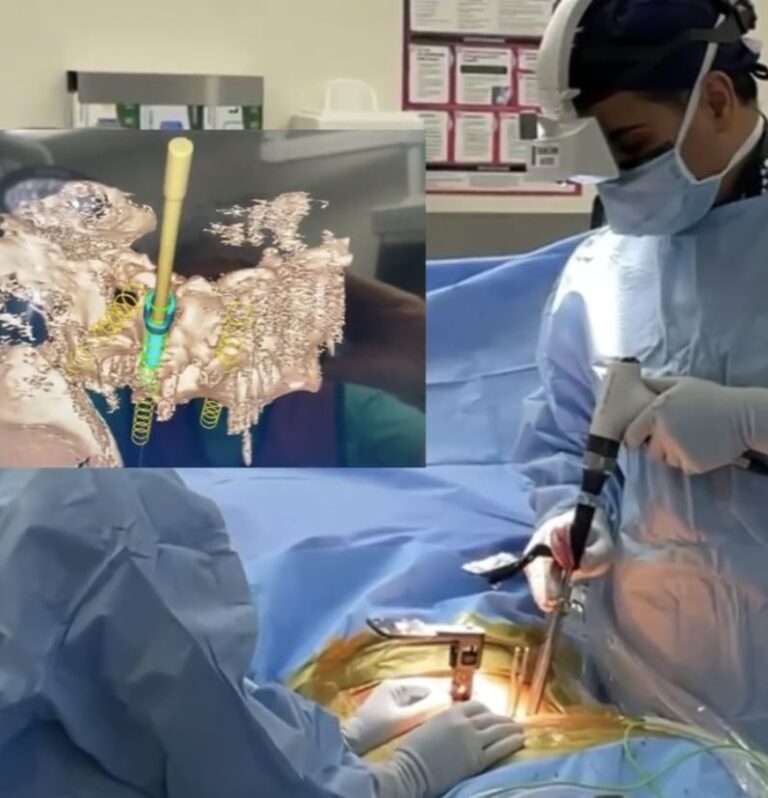 Augmented reality used in spine surgery