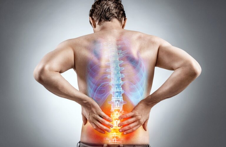 Get Your Questions Answered About Degenerative Disc Disease
