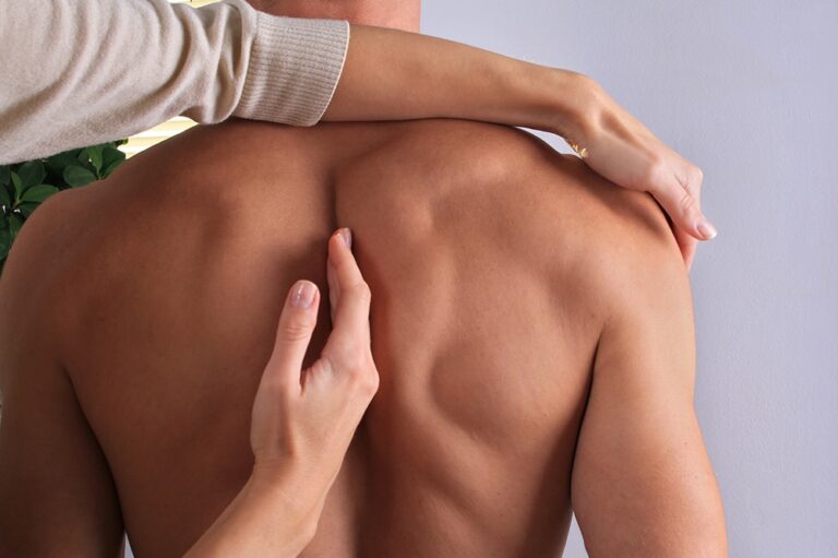 Non-Operative Treatment Options For Scoliosis: Physical Therapy & Schroth Method