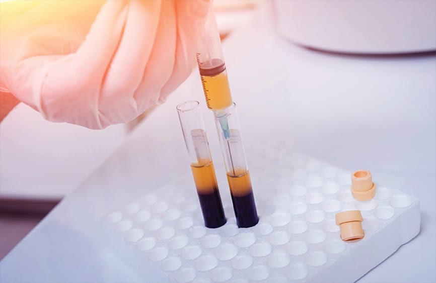 PRP needle