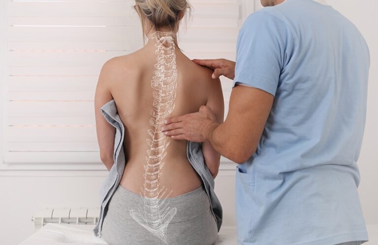 Set That Scoliosis Straight! An Overview Of Scoliosis