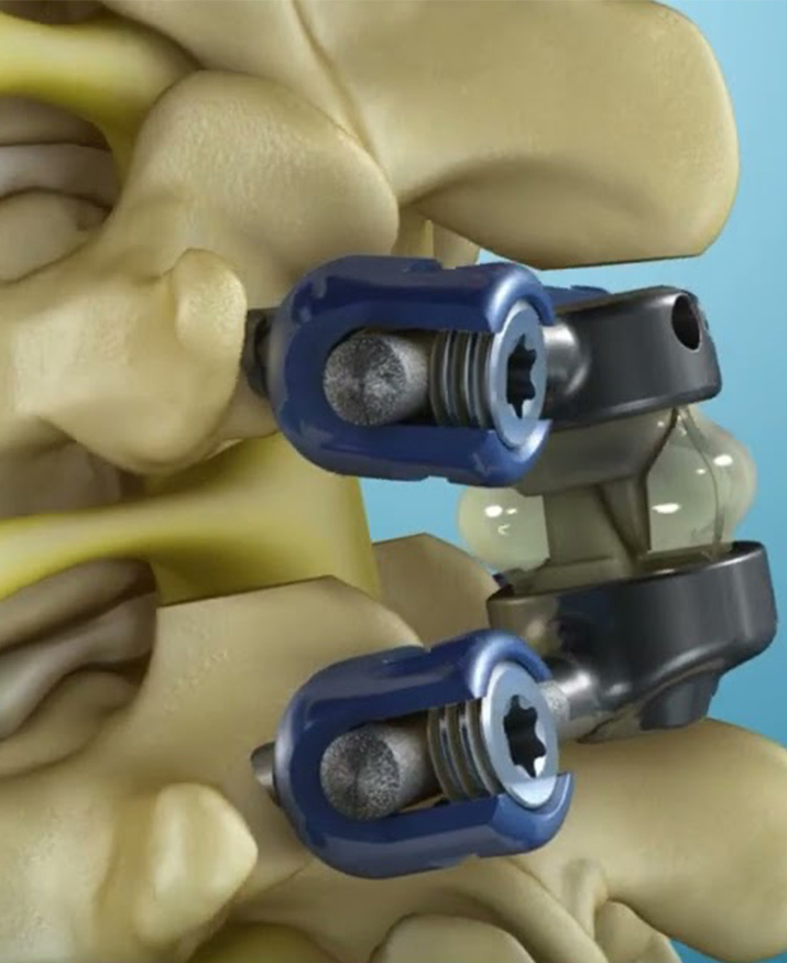 tops system computer image